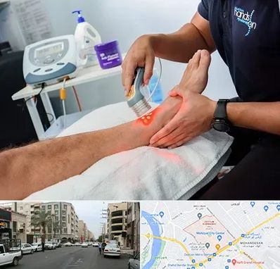 لیزر تراپی در زیتون کارمندی اهواز