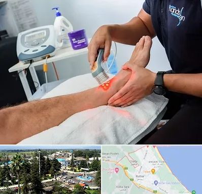 لیزر تراپی در رودسر