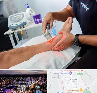 لیزر تراپی در گلسار رشت