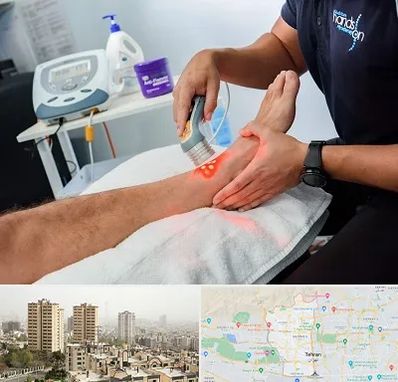 لیزر تراپی در منطقه 5 تهران