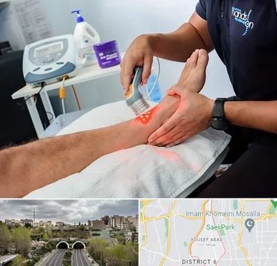 لیزر تراپی در یوسف آباد