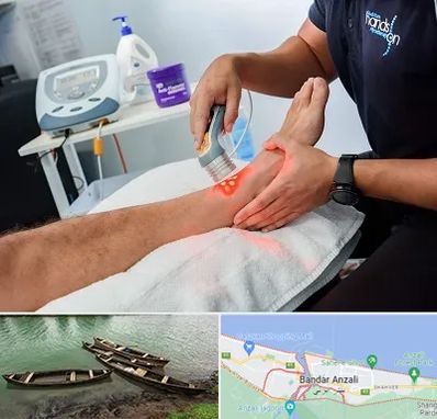 لیزر تراپی در بندر انزلی