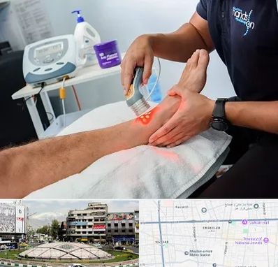 لیزر تراپی در مرکز تهران