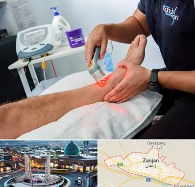 لیزر تراپی در زنجان