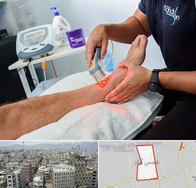 لیزر تراپی در شمس آباد تهران