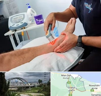 لیزر تراپی در چالوس