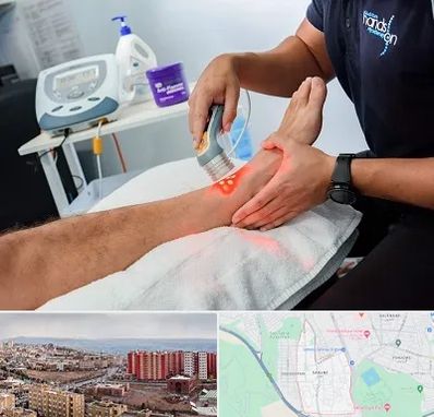 لیزر تراپی در سهند تبریز