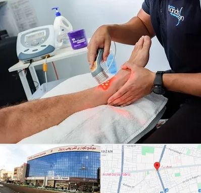 لیزر تراپی در نصف راه تبریز