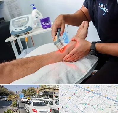 لیزر تراپی در مفتح مشهد