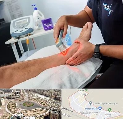 لیزر تراپی در پرند