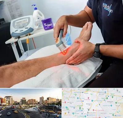 لیزر تراپی در منطقه 7 تهران