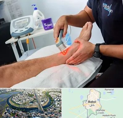 لیزر تراپی در بابل