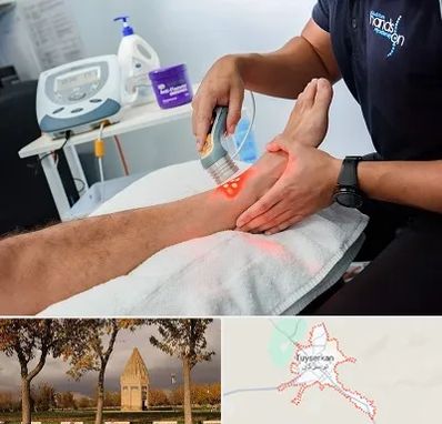 لیزر تراپی در تویسرکان