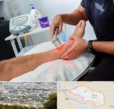 لیزر تراپی در یاسوج