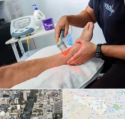 لیزر تراپی در منطقه 18 تهران