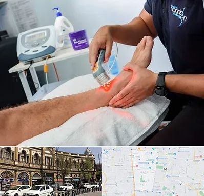 لیزر تراپی در منطقه 11 تهران