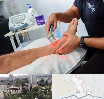 لیزر تراپی در اوین