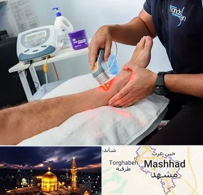 لیزر تراپی در مشهد