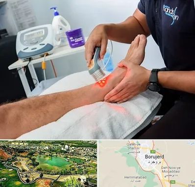 لیزر تراپی در بروجرد