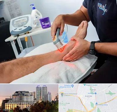 لیزر تراپی در فرشته