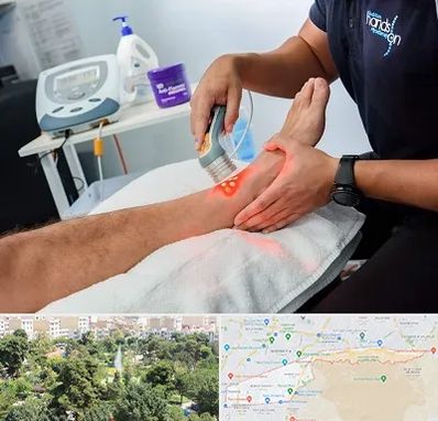 لیزر تراپی در منطقه 13 تهران