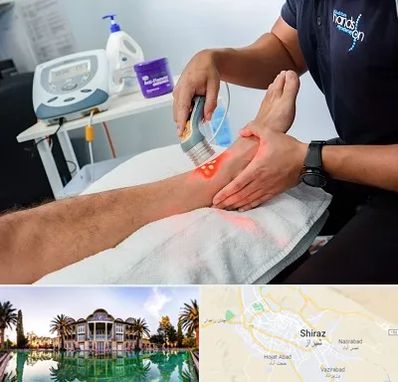 لیزر تراپی در شیراز