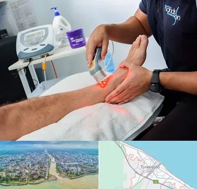 لیزر تراپی در تنکابن