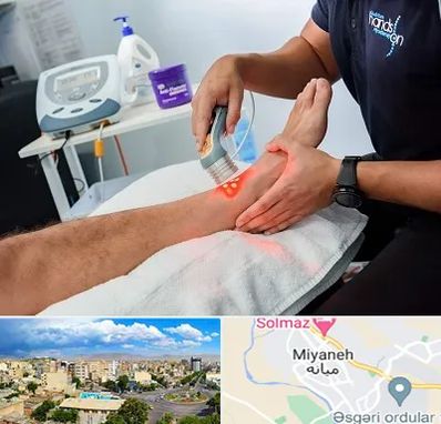 لیزر تراپی در میانه