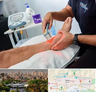 لیزر تراپی در منطقه 1 تهران