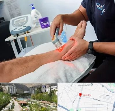 لیزر تراپی در بلوار تعاون