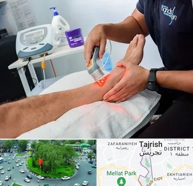 لیزر تراپی در تجریش