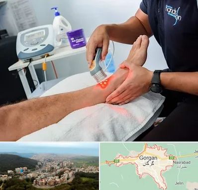 لیزر تراپی در گرگان