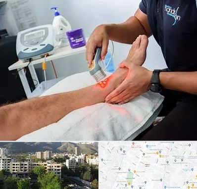 لیزر تراپی در دیباجی