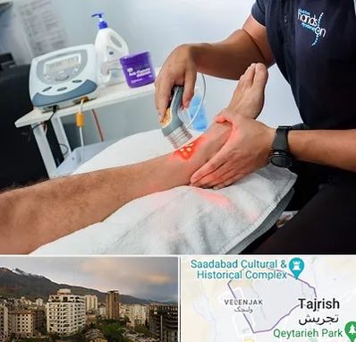 لیزر تراپی در زعفرانیه