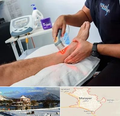 لیزر تراپی در ملایر