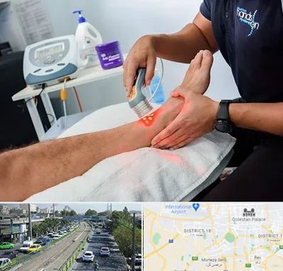 لیزر تراپی در جنوب تهران