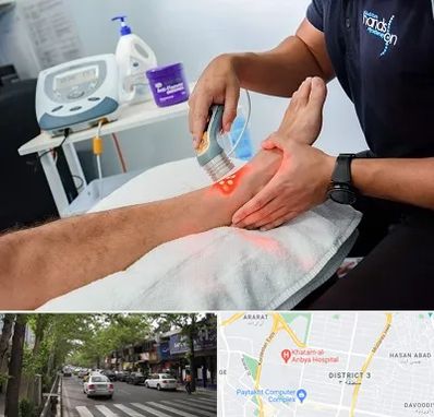 لیزر تراپی در ظفر