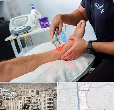 لیزر تراپی در اسکندری