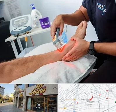 لیزر تراپی در عطاران قم