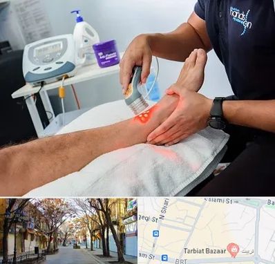 لیزر تراپی در تربیت تبریز