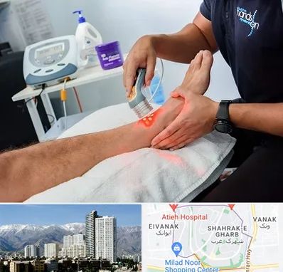 لیزر تراپی در شهرک غرب