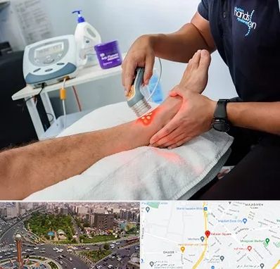 لیزر تراپی در سبلان