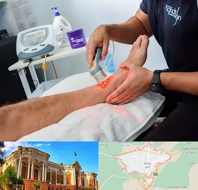 لیزر تراپی در خوی