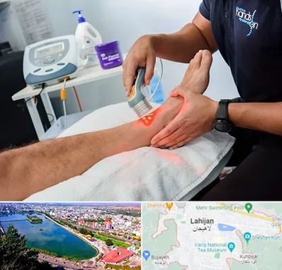 لیزر تراپی در لاهیجان