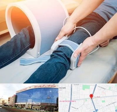 مگنت تراپی در نصف راه تبریز