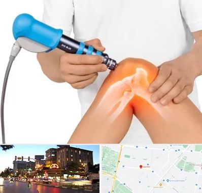 شاک ویو تراپی در بلوار سجاد مشهد