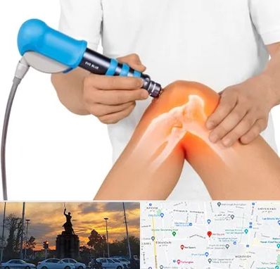 شاک ویو تراپی در میدان حر