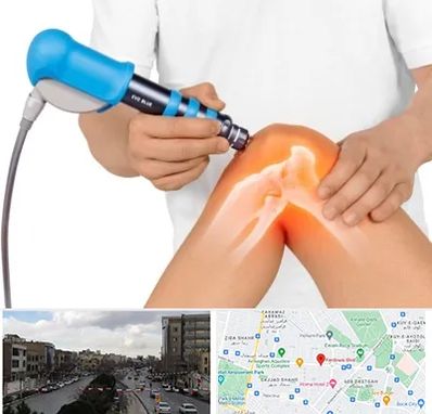 شاک ویو تراپی در بلوار فردوسی مشهد