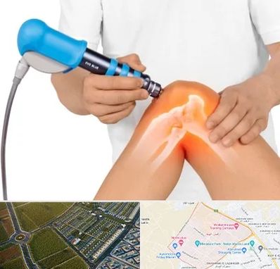 شاک ویو تراپی در الهیه مشهد