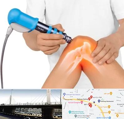 شاک ویو تراپی در پارک وی